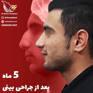 جراحی-بینی-1