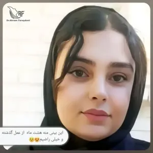 جراحی-بینی-174