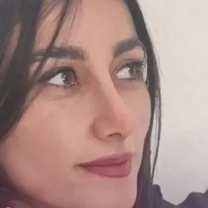 جراحی-بینی-175