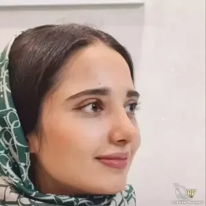 جراحی-بینی-176