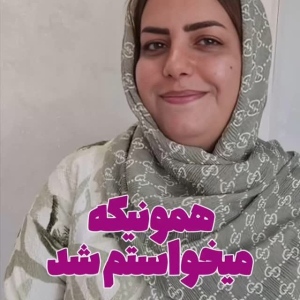 جراحی-بینی-179