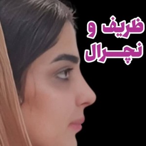 جراحی-بینی-180