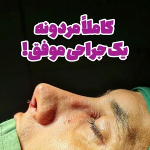 جراحی-بینی-187