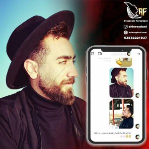 جراحی-بینی-39