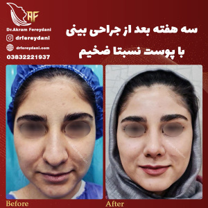 جراحی-بینی83