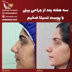 جراحی-بینی84