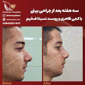 جراحی-بینی87