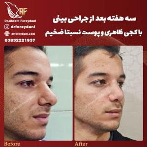 جراحی-بینی88