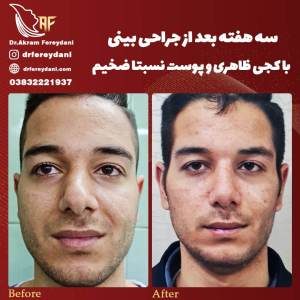 جراحی-بینی89