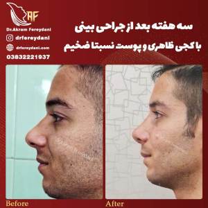 جراحی-بینی91