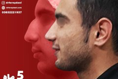 جراحی-بینی-1