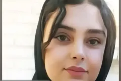 جراحی-بینی-174
