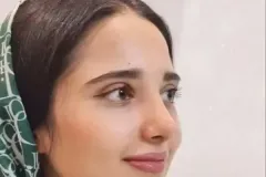 جراحی-بینی-176