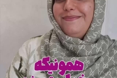 جراحی-بینی-179