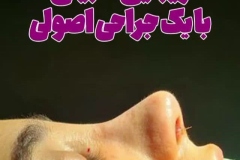 جراحی-بینی-184
