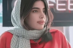 جراحی-بینی-186