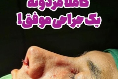 جراحی-بینی-187