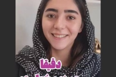 جراحی-بینی-189