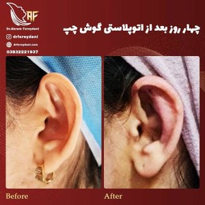 جراحی-گوش-1