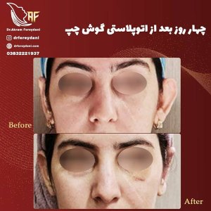 جراحی-گوش-2
