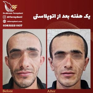 جراحی-گوش-3