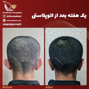 جراحی-گوش-5