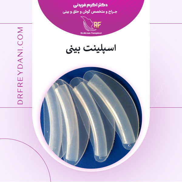 اسپیلنت بینی _ دکتر اکرم فریدنی