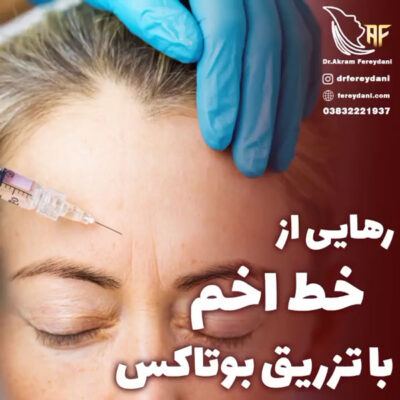 تزریق بوتاکس -- دکتر فریدنی