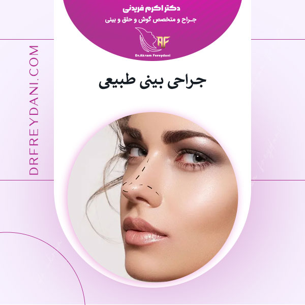 جراحی بینی طبیعی - دکتر اکرم فریدنی