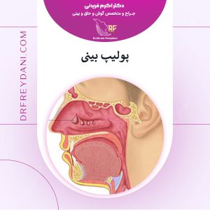 پولیپ بینی - دکتر اکرم فریدنی