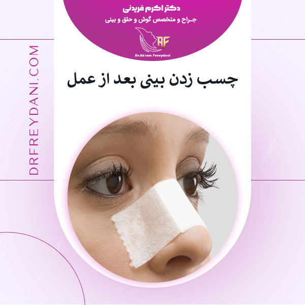 چسب زدن بینی بعد از عمل _ دکتر اکرم فریدنی