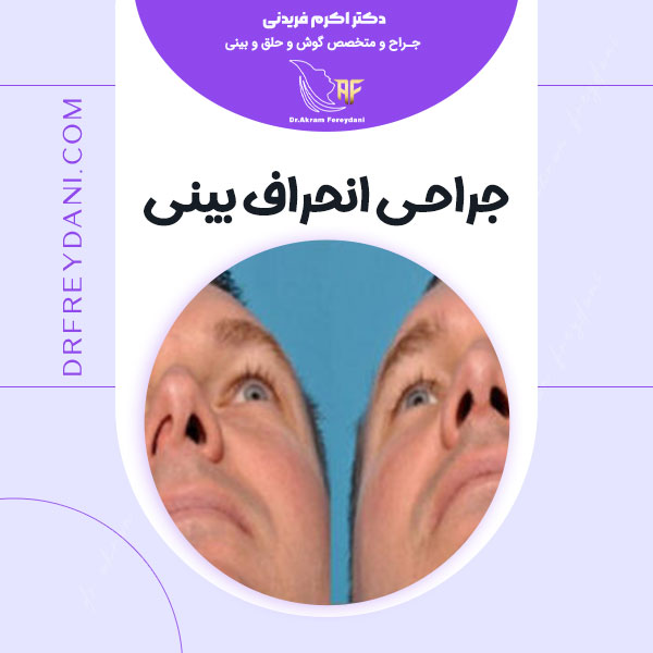 جراحی انحراف بینی