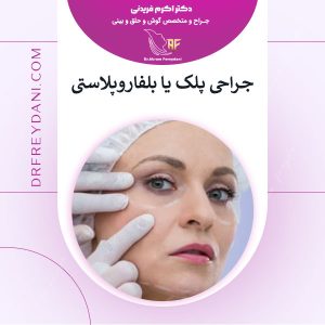 جراحی زیبایی پلک در شهر کرد _ دکتر اکرم فریدنی