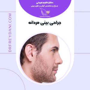 عمل بینی مردانه - دکتر فریدنی