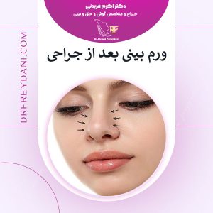 ورم بعد از جراحی بینی - دکتر فریدنی