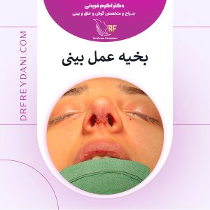 بخیه عمل بینی _ دکتر اکرم فریدنی