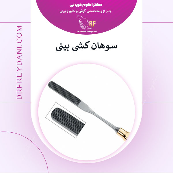 سوهان کشی بینی بعد از عمل _ دکتر اکرم فریدنی