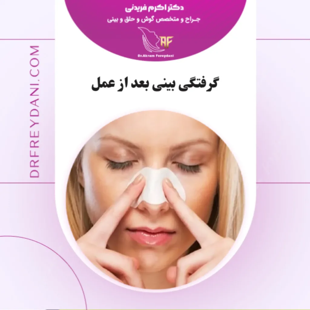 گرفتگی بینی بعد از عمل _ دکتر اکرم فریدنی