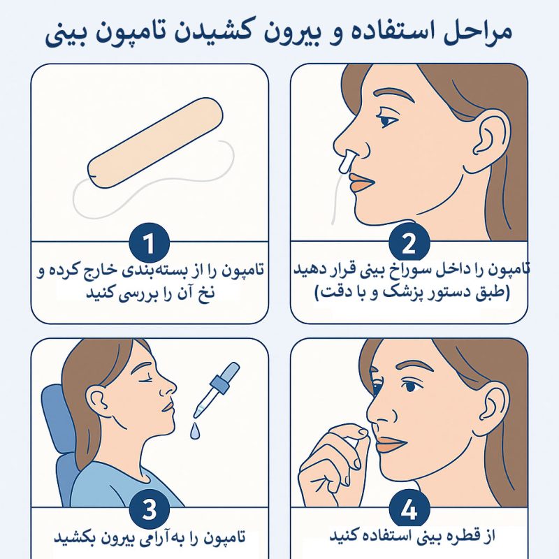 مراحل استفاده برداشتن تامپون بینی 