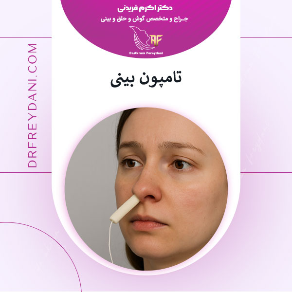 تامپون بینی