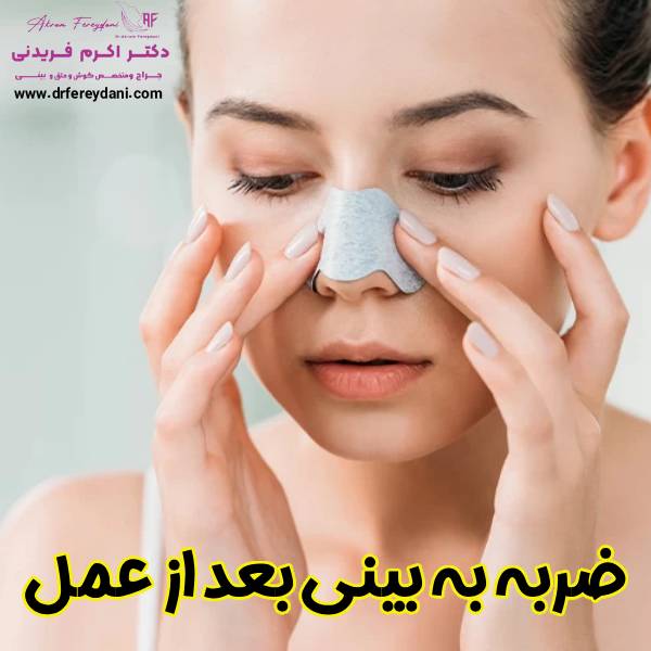 عکس ضربه خوردن بینی بعد عمل - دکتر اکرم فریدنی