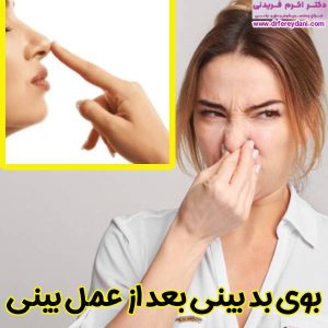 بوی بد بینی بعد عمل بینی - دکتر اکرم فریدنی