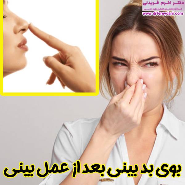 بوی بد بینی بعد عمل بینی - دکتر اکرم فریدنی