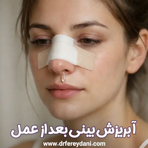 آبریزش بینی بعد از عمل - دکتر اکرم فریدنی