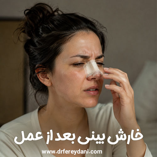 خارش بینی بعد از عمل + دکتر اکرم فریدنی