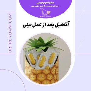 آناهیل بعد از عمل بینی